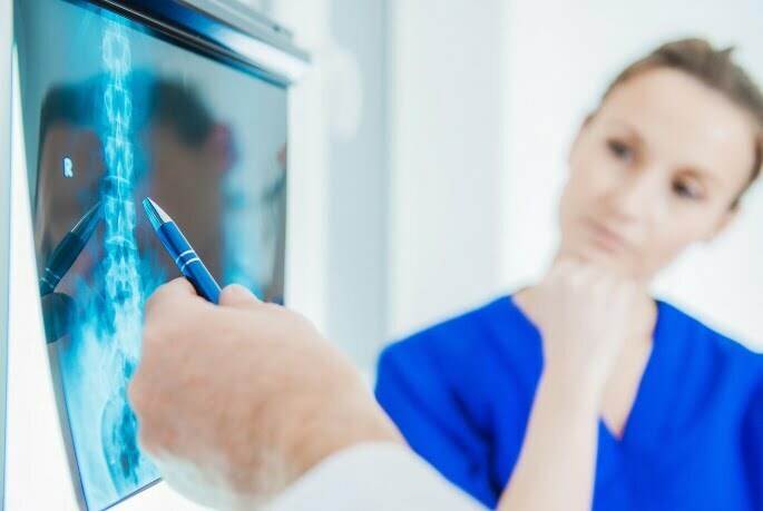 Doctors Looking at X-Ray of Spinal Cord Stimulator Implant in Chicago, IL