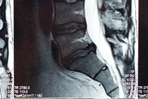 Free MRI Review