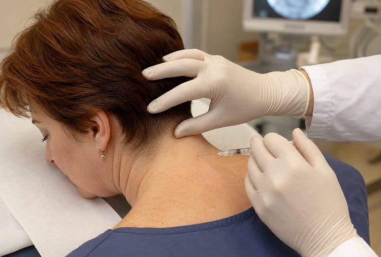 Cervical epidural steroid injection procedure illustration