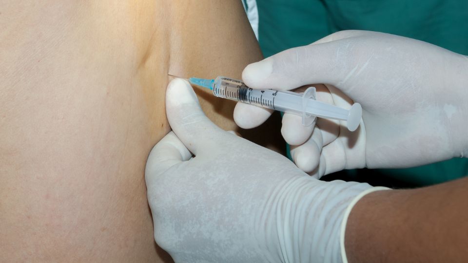 Facet Joint Injection vs Epidural Injection The Main Facet Joint