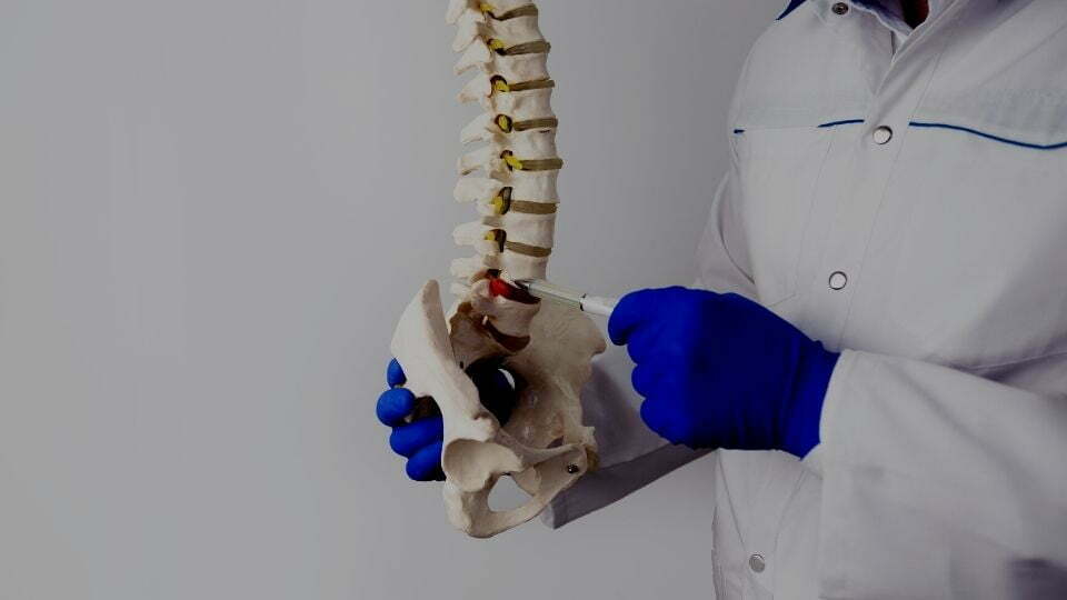 How Long Does a Herniated Disc Take to Heal? A Look at Your Recovery Timeline