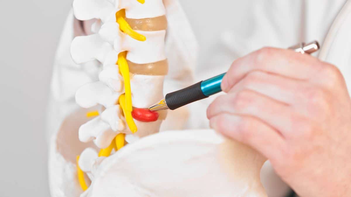 Is It Possible to Navigate Work With a Herniated Disc?