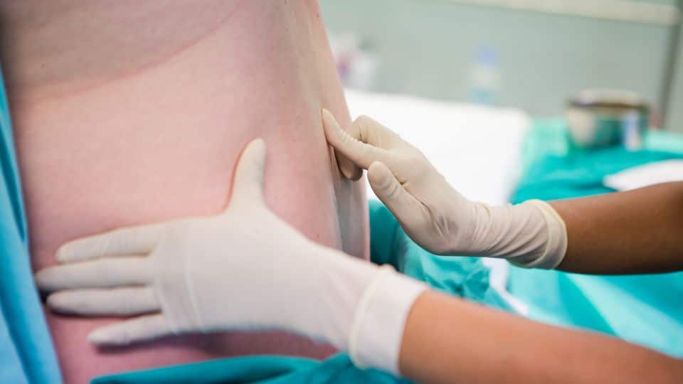 How Long Does An Epidural Steroid Injection Last?
