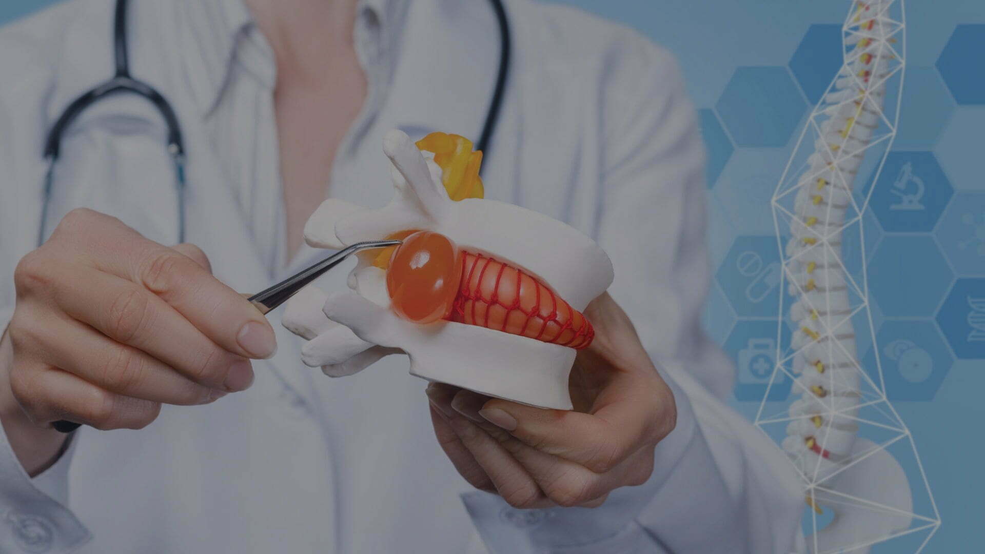 Best Strategies for How to Heal a Herniated Disc Quickly